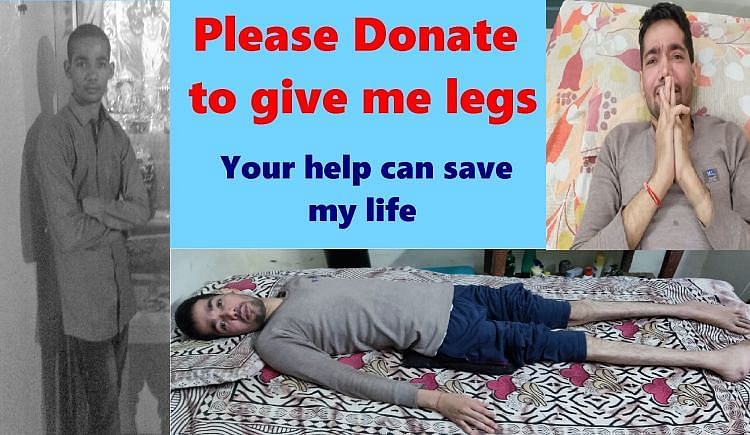 Your Little Donation Can Give Legs To Deepak - Ketto